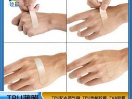 TPU透明醫用薄膜 一次性tpu醫療膜 源頭廠家  贊晨